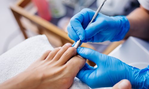 Pedicuria
